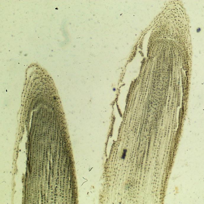 Preparación microscópica de mitosis de células de planta
