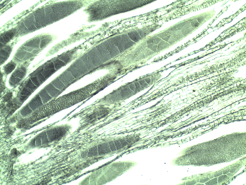 Preparación microscópica de musgo (anteridio)
