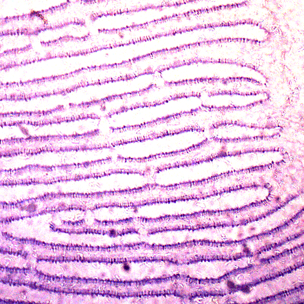 Preparación microscópica de hongo sombrilla