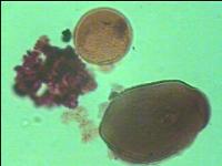 Preparación microscópica de polen