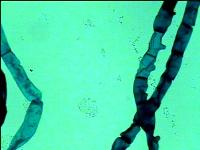 Preparación microscópica de spirogyra mostrando cloroplasto