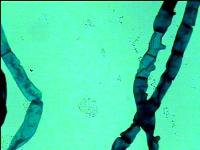 Spirogyra mostrando cloroplasto