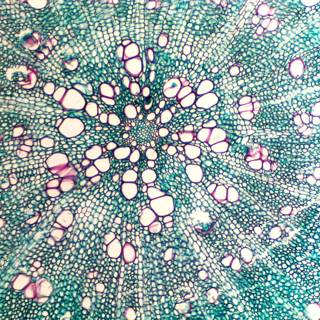 Preparación microscópica de raíz maderosa de tilio tipo de árbol)