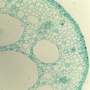 Preparación microscópica de tallo sumergido de flor acuática (nymphaea)