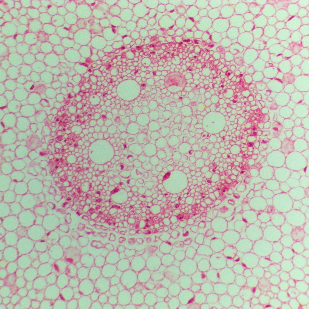 Raíz de monocotiledóneas