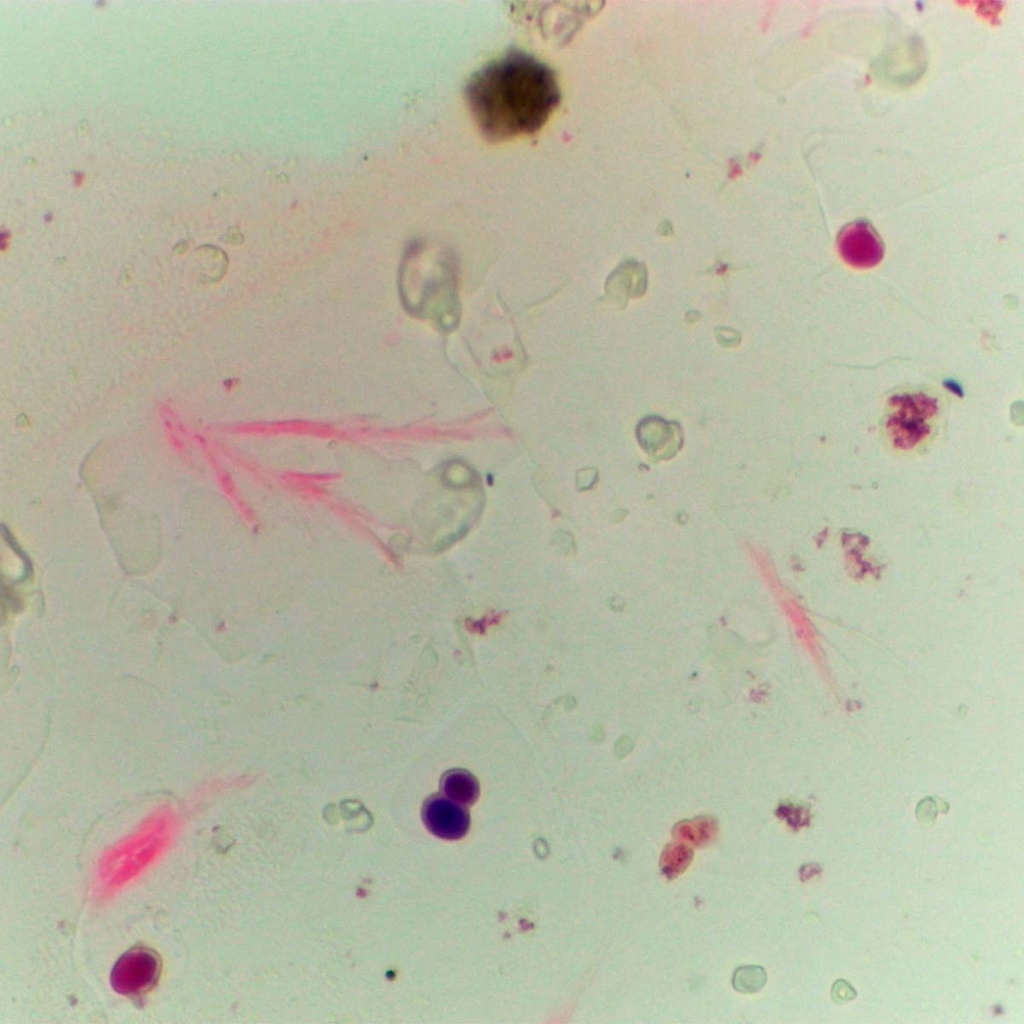 Preparación microscópica de levaduras