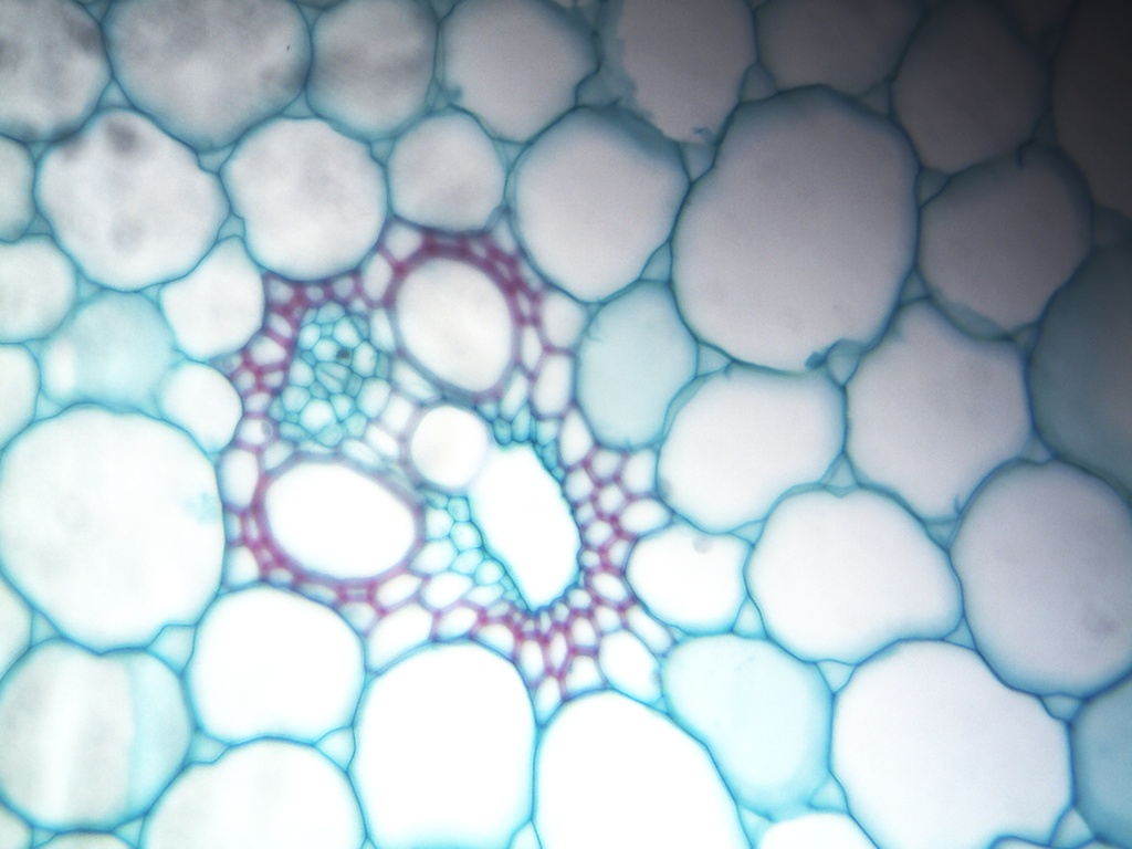 Tallo de monocotiledonea