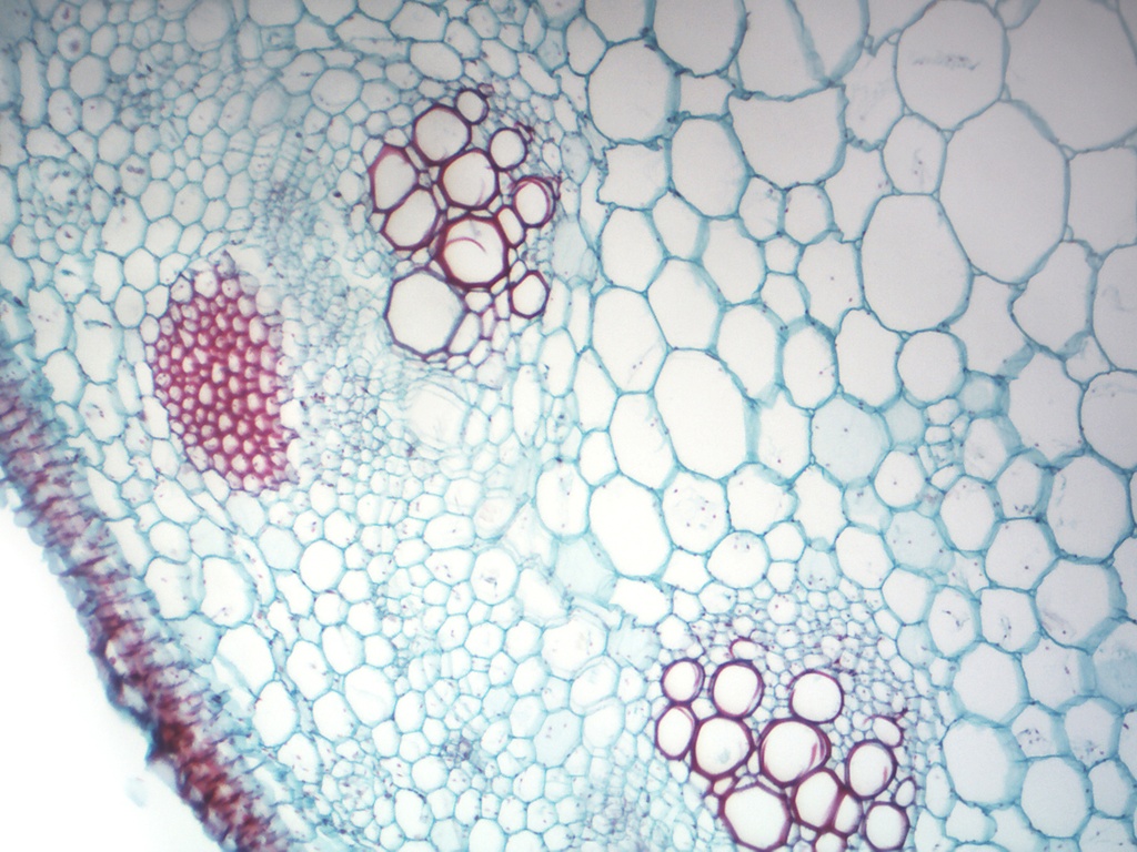 Preparación microscópica de tallo de monocotiledonea