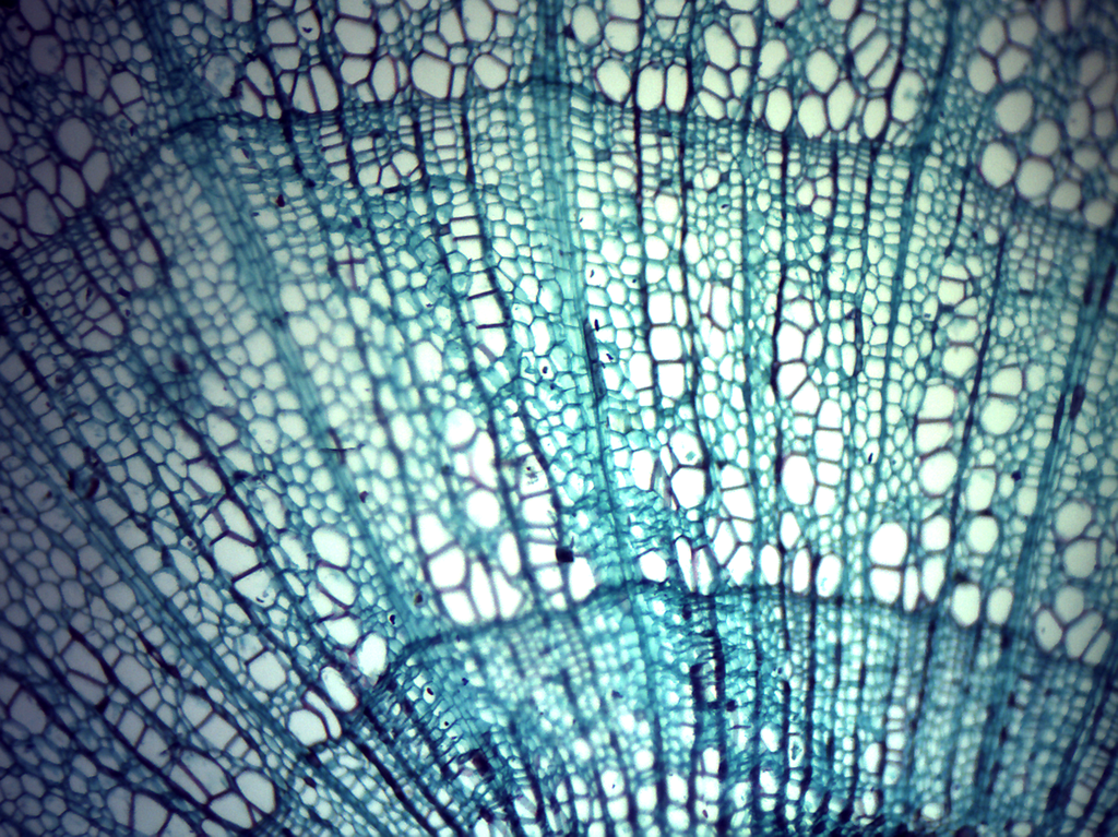 Tallo de monocotiledónea