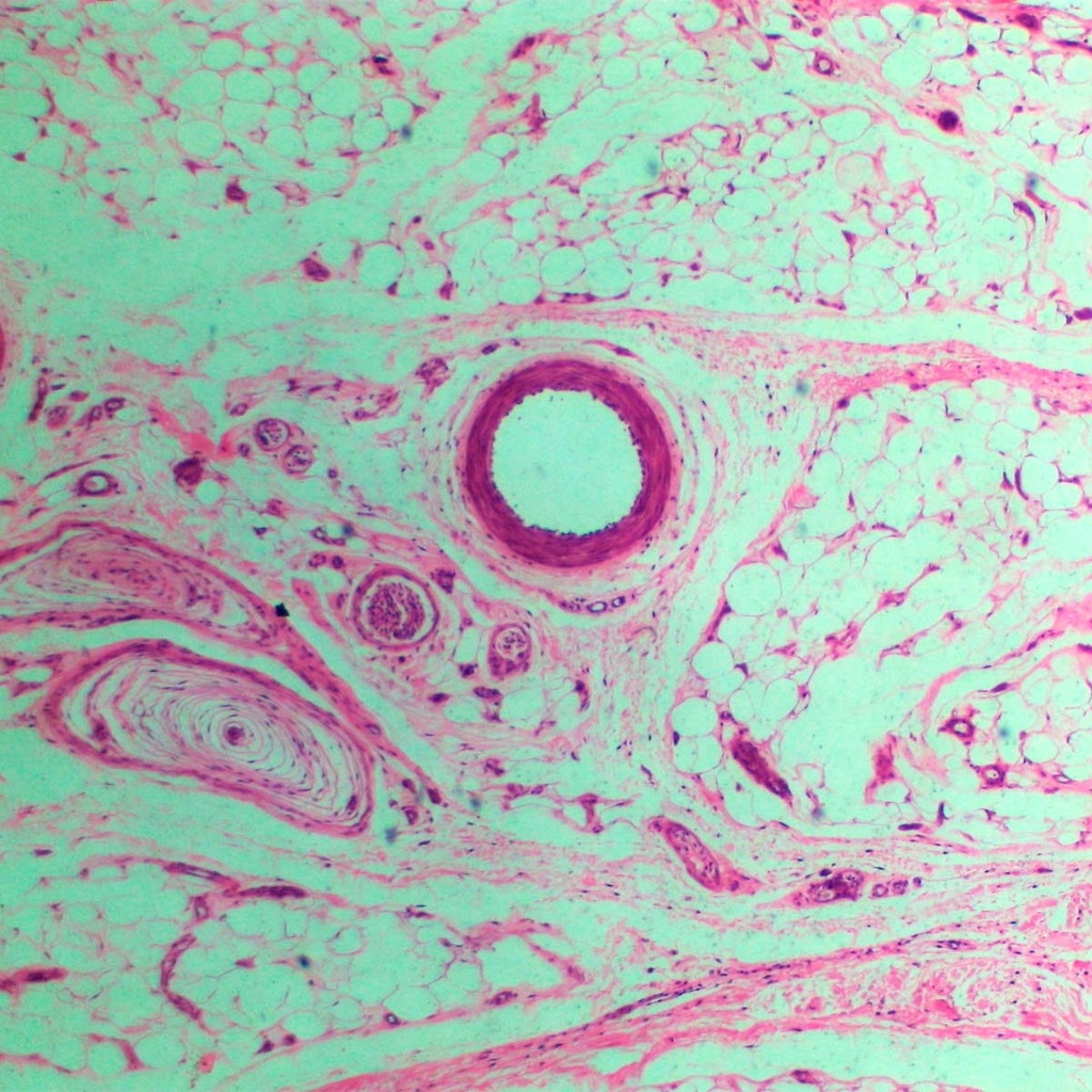 Preparación microscópica de epitelio escamoso