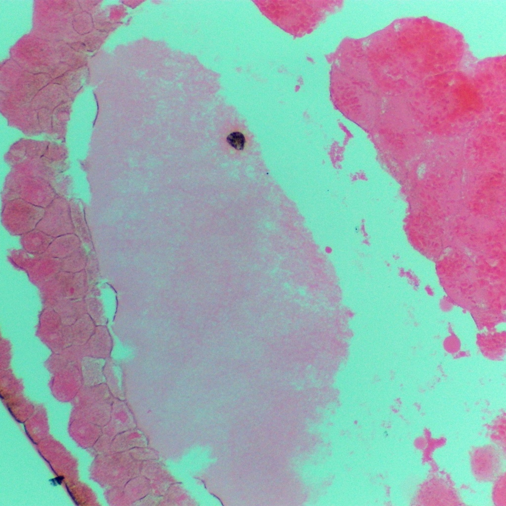 Etapas de morula, blastula y gástrula