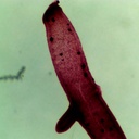 Preparación microscópica de hydra muestra cuerpo, boca y tentáculo