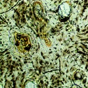 Preparación microscópica de hueso denso, con cavidades y canales