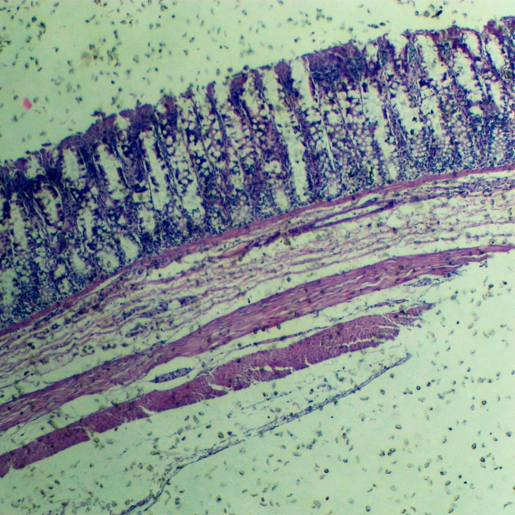 Preparación microscópica de moho rhizopus