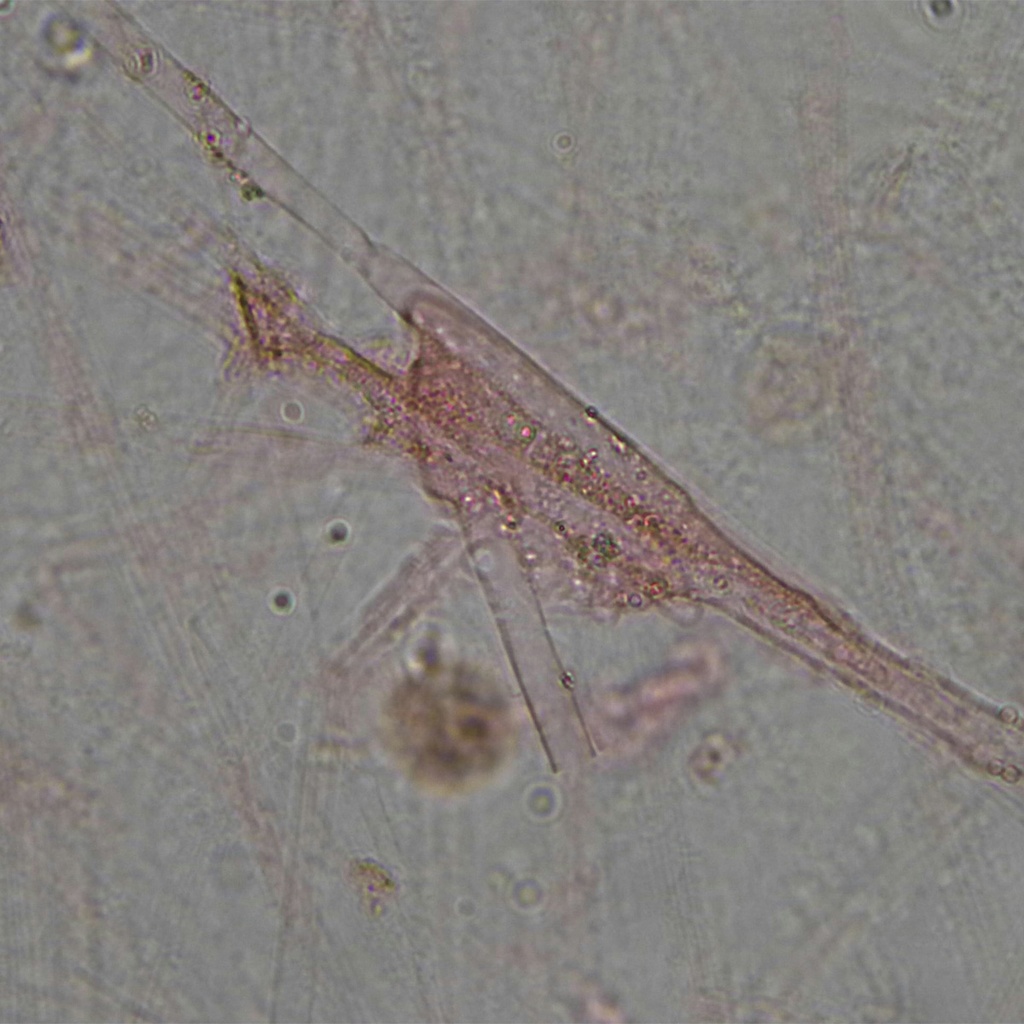 Preparación microscópica de colon con células mucosas resaltadas