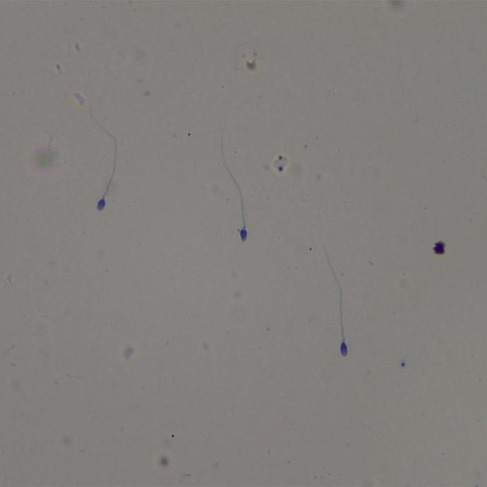 Preparación microscópica de semen de toro