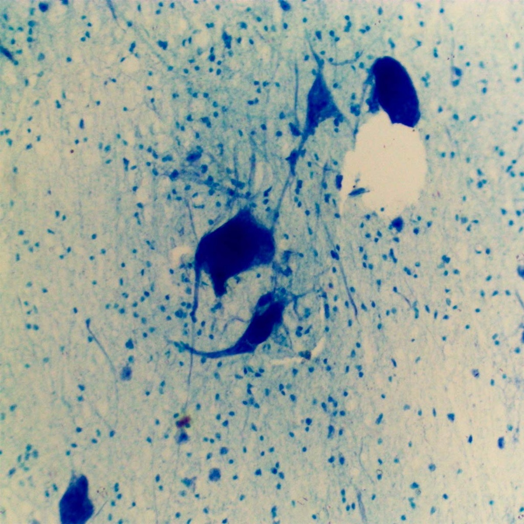 Preparación microscópica de neuronas