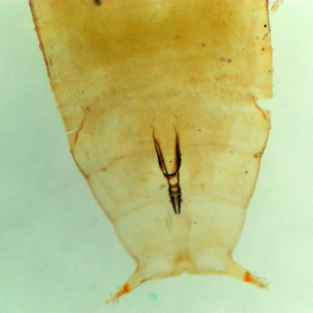 Preparación microscópica de ácaro