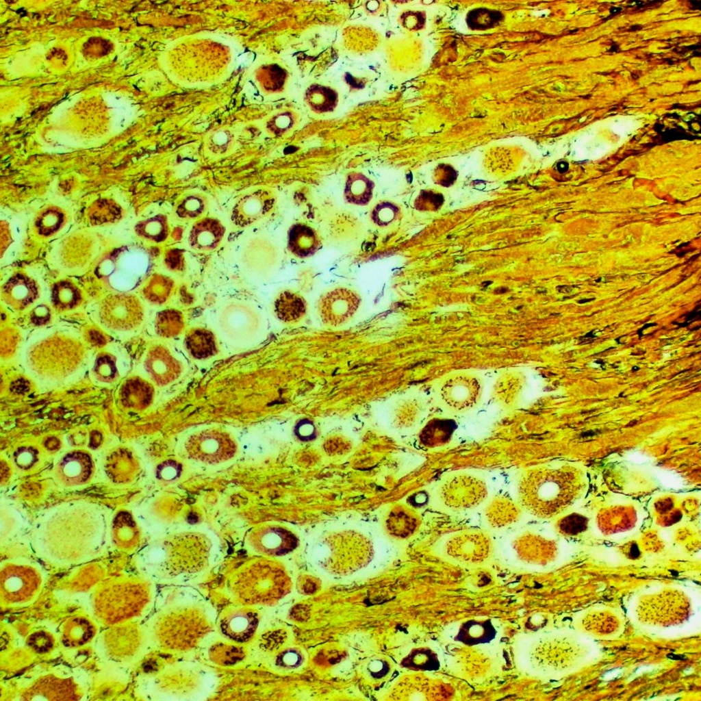 Preparación microscópica de aparato de golgi