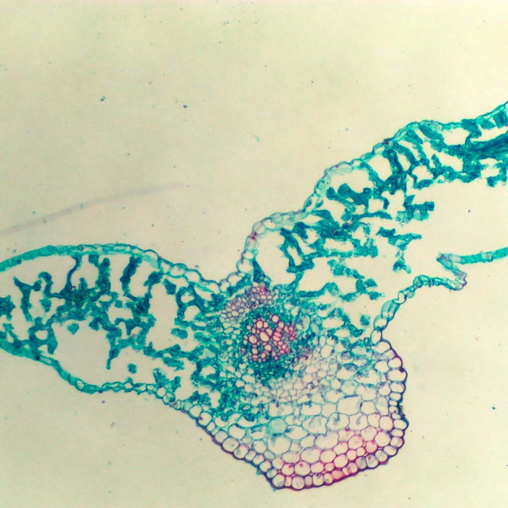 Preparación microscópica de cloroplastos