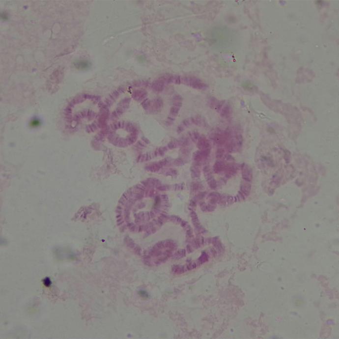 Preparación microscópica de cromosomas
