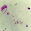 Preparación microscópica de bacteria de agua (Effluent)