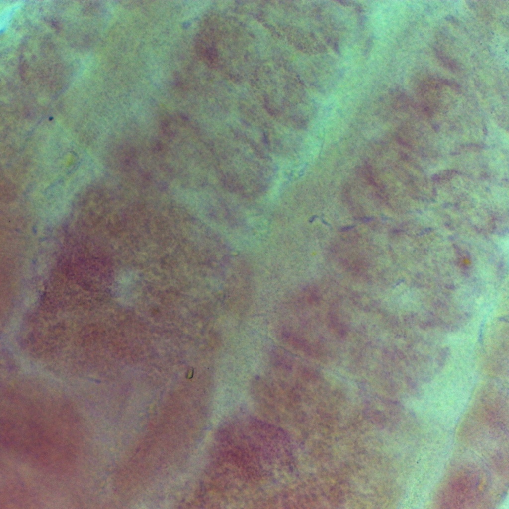 Taenia solium madura