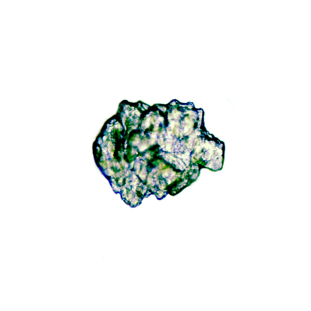 Preparación microscópica de ascariosis (parásito)