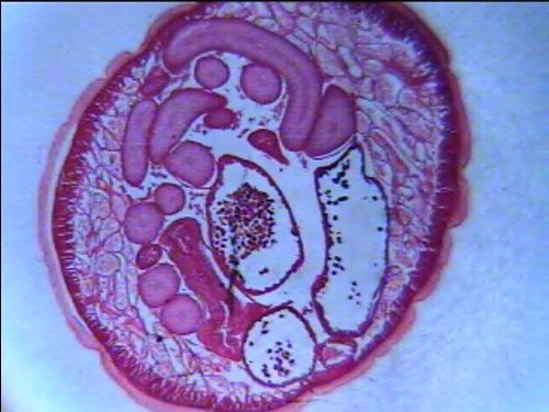 Preparación microscópica de gusano parásito macho y hembra
