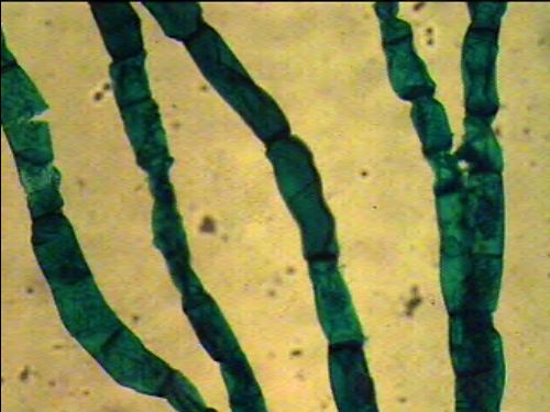Preparación microscópica de mitosis de sprirogyra (género de algas verdes)