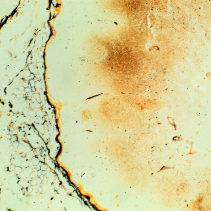 Preparación microscópica de tejido de areola