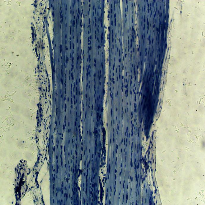 Músculo esquelético