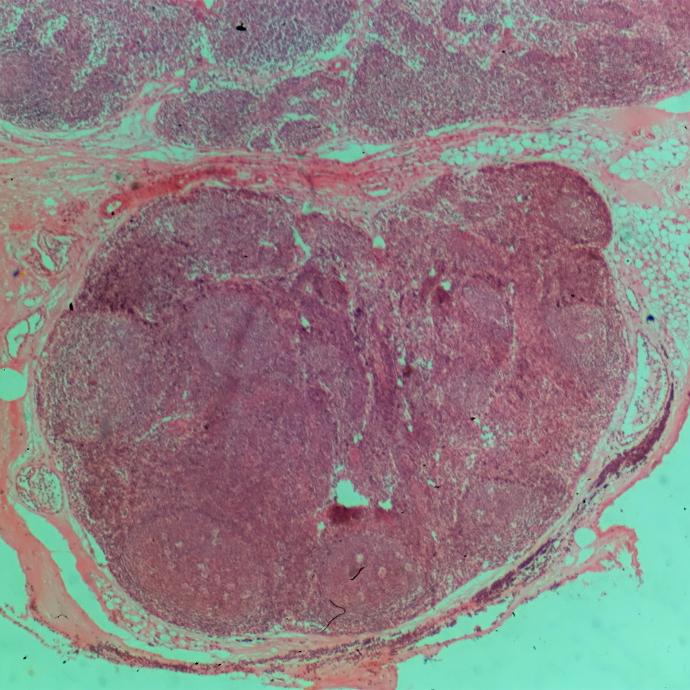 Tejido de ganglios linfáticos