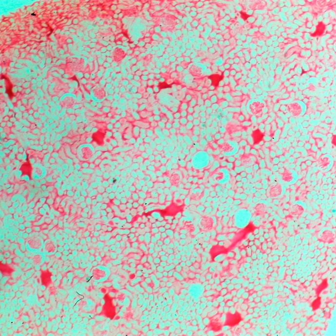 Tejido de riñón con vasos sanguíneos