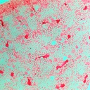 Preparación microscópica de tejido de riñón con vasos sanguíneos