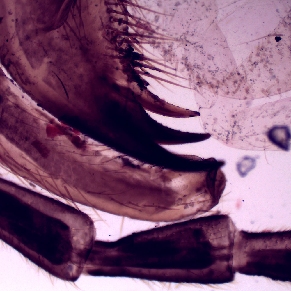 Preparación microscópica de partes de la boca de grillo