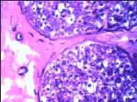 Preparación microscópica de arterias y venas elásticas
