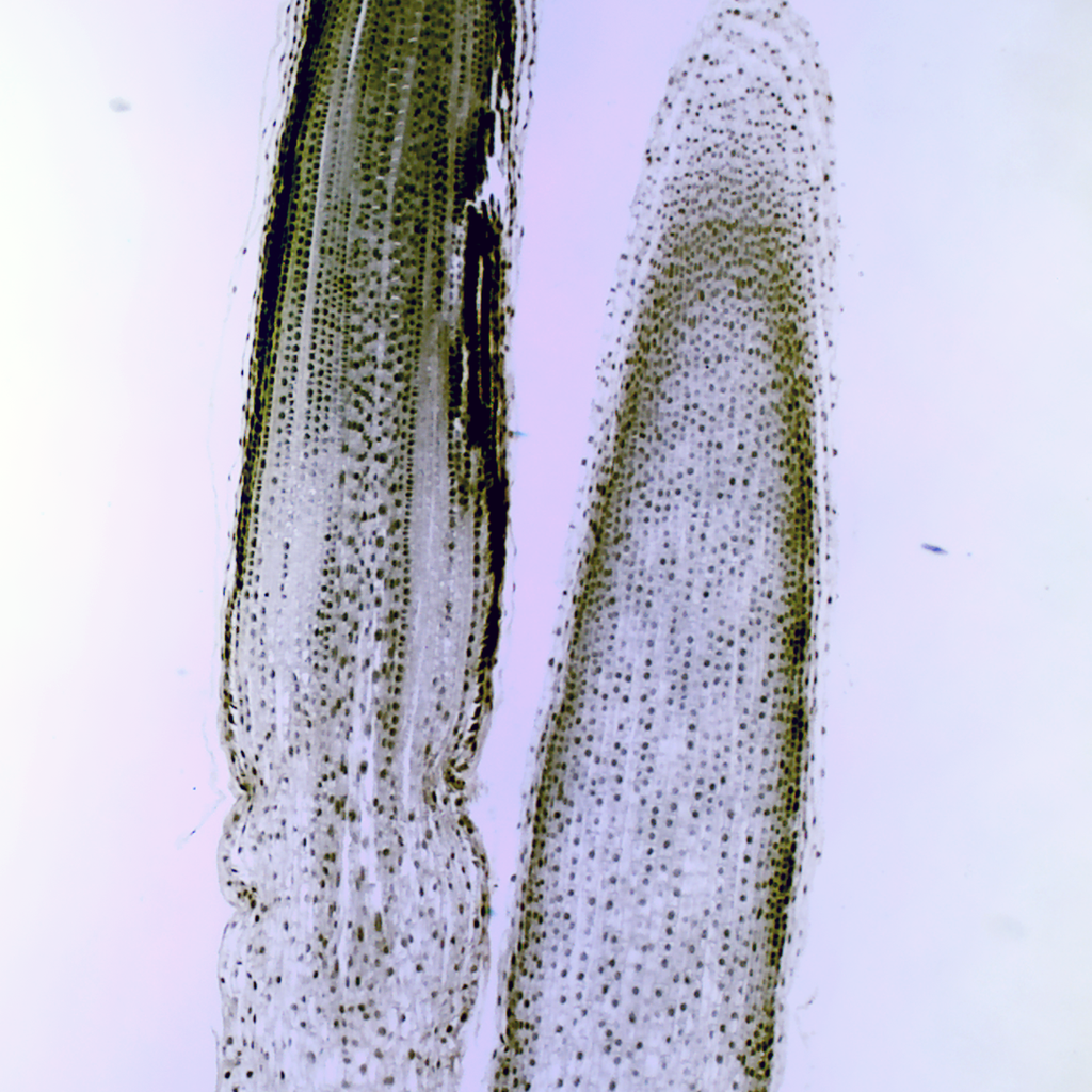 Preparación microscópica de chlamydomonas (tipo de alga verde)