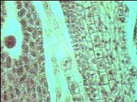 Preparación microscópica de musgo (arquegonio)