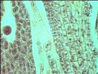 Preparación microscópica de musgo (arquegonio)