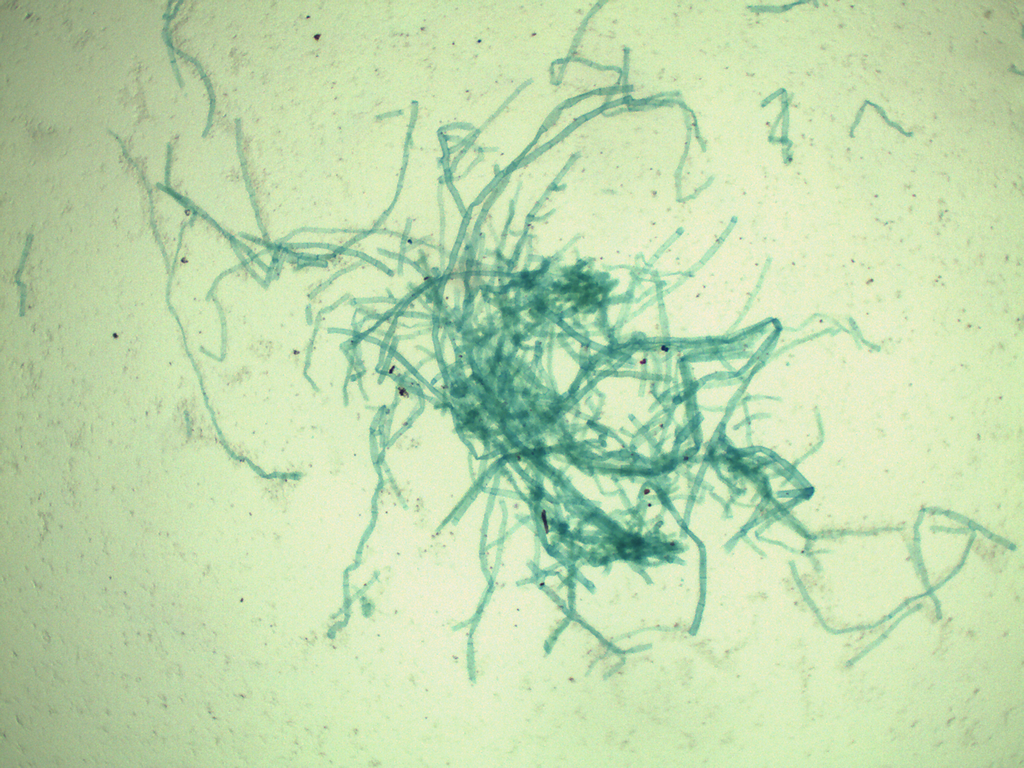 Preparación microscópica de protonema (primera etapa) de musgo