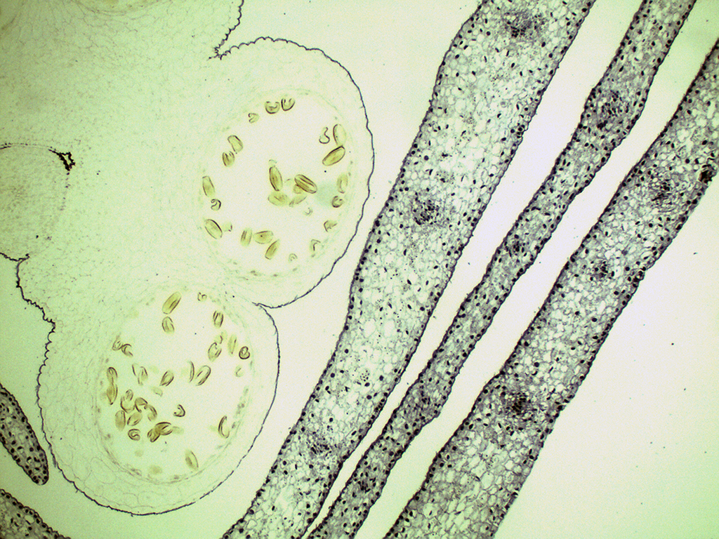Preparación microscópica de bulbo (sección reproductiva) de lirio