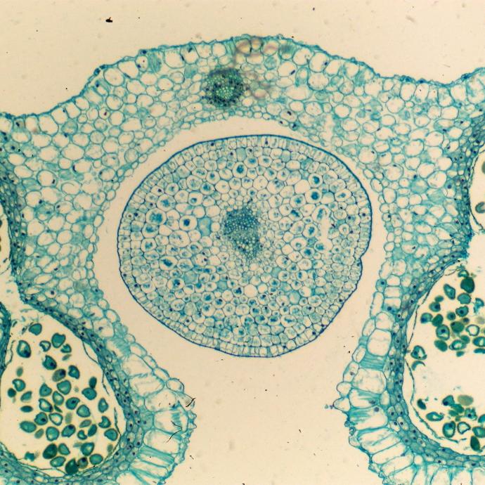 Preparación microscópica de antera de lirio (flor)