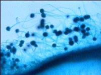 Hongo (moho) aspergillus