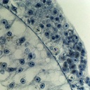 Preparación microscópica de ovario de hydra