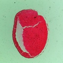 Preparación microscópica de gástrula de rana en etapa tardía