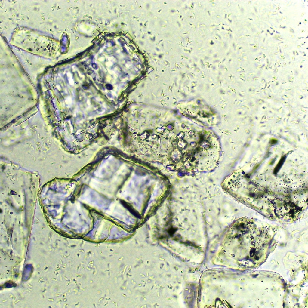 Preparación microscópica de cristales de sal