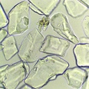 Preparación microscópica de cristales de azúcar