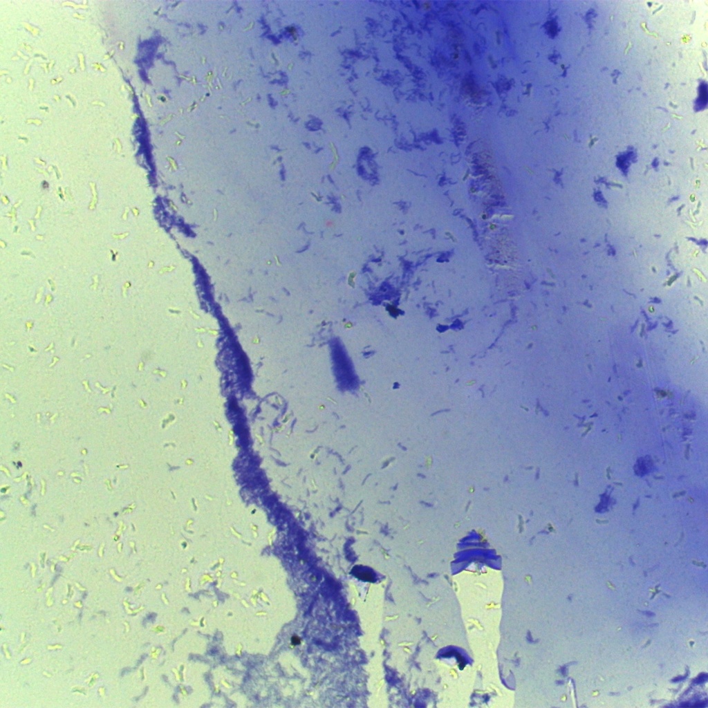 Preparación microscópica de bacillus anthracis bacteria gram +
