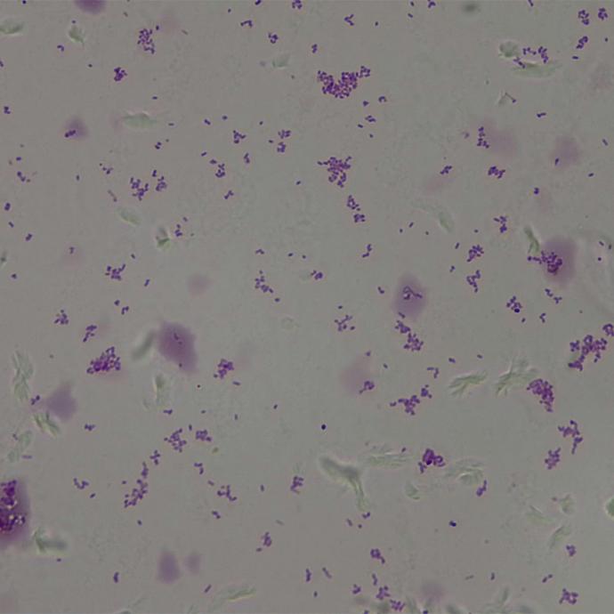 Preparación microscópica de bacillus gram -